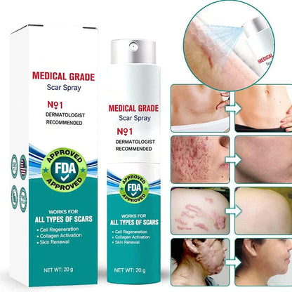 South Moon Medical Grade Scar Removal Spray – For All Types of Scars (20g)