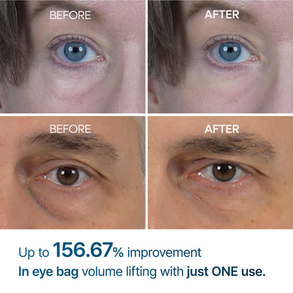 Dr Melaxin Eyephalt Eye Bag Cream (100%Original)
