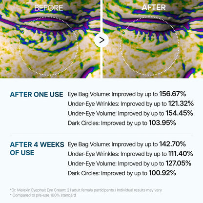 Dr Melaxin Eyephalt Eye Bag Cream (100%Original)