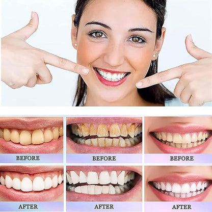 Oralhoe - Nicotinamide Dazzle White Toothpaste (Original)