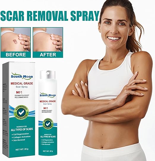 South Moon Medical Grade Scar Removal Spray – For All Types of Scars (20g)