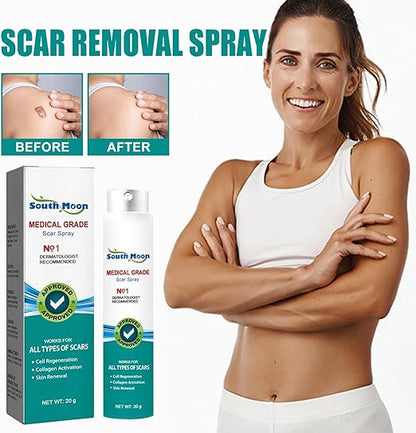 South Moon Medical Grade Scar Removal Spray – For All Types of Scars (20g)